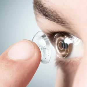 Lentille sclérale Smartlens conçue pour une correction visuelle spécialisée sur mesure